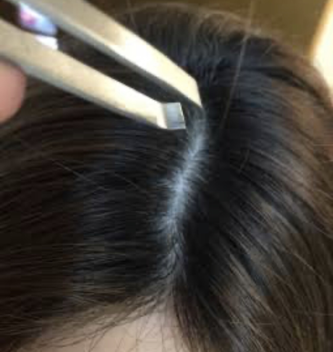 白髪を抜くとまっている恐ろしい末路…。日本橋小伝馬町美容室【altema】が教える髪の毛の寿命。 | altema