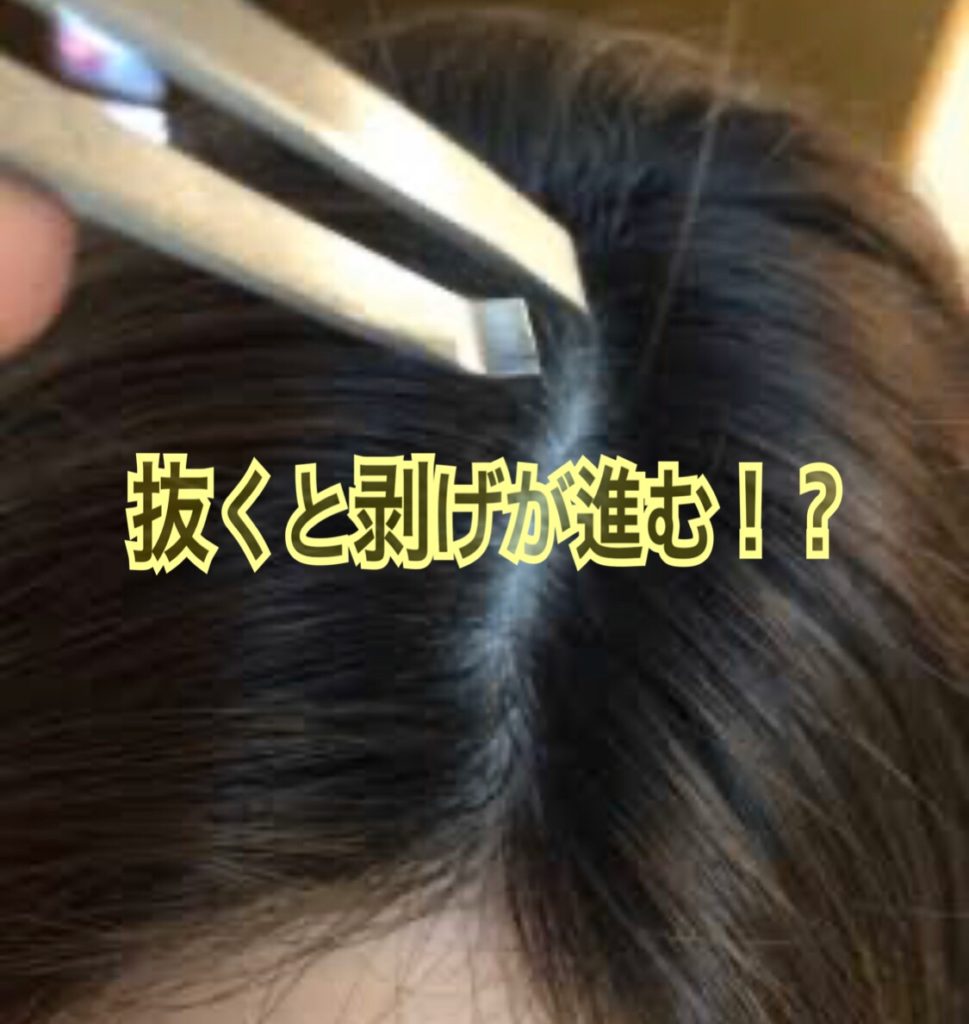 白髪を抜くとまっている恐ろしい末路 日本橋小伝馬町美容室 Altema が教える髪の毛の寿命 Altema